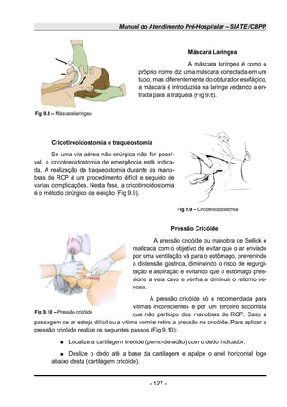Manual do Atendimento Pré-Hospitalar – SIATE /CBPR
Máscara Laríngea
A máscara laríngea é como o
próprio nome diz uma máscara conectada em um
tubo, mas diferentemente do obturador esofágico,
a máscara é introduzida na laringe vedando a en-
trada para a traquéia (Fig 9.8).
Cricotireoidostomia e traqueostomia
Se uma via aérea não-cirúrgica não for possí-
vel, a cricotireoidostomia de emergência está indica-
da. A realização da traqueostomia durante as mano-
bras de RCP é um procedimento difícil e seguido de
várias complicações. Nesta fase, a cricotireoidostomia
é o método cirúrgico de eleição (Fig 9.9).
Pressão Cricóide
A pressão cricóide ou manobra de Sellick é
realizada com o objetivo de evitar que o ar enviado
por uma ventilação vá para o estômago, prevenindo
a distensão gástrica, diminuindo o risco de regurgi-
tação e aspiração e evitando que o estômago pres-
sione a veia cava e venha a diminuir o retorno ve-
noso.
A pressão cricóide só é recomendada para
vítimas inconscientes e por um terceiro socorrista
que não participa das manobras de RCP. Caso a
passagem de ar esteja difícil ou a vítima vomite retire a pressão na cricóide. Para aplicar a
pressão cricóide realize os seguintes passos (Fig 9.10):
● Localize a cartilagem tireóide (pomo-de-adão) com o dedo indicador.
● Deslize o dedo até a base da cartilagem e apalpe o anel horizontal logo
abaixo desta (cartilagem cricóide).
- 127 -
Fig 9.8 – Máscara laríngea
Fig 9.9 – Cricotireoidostomia
Fig 9.10 – Pressão cricóide
 