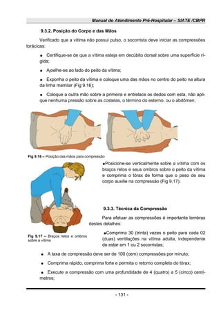 Manual do Atendimento Pré-Hospitalar – SIATE /CBPR
9.3.2. Posição do Corpo e das Mãos
Verificado que a vítima não possui pulso, o socorrista deve iniciar as compressões
torácicas:
● Certifique-se de que a vítima esteja em decúbito dorsal sobre uma superfície rí-
gida;
● Ajoelhe-se ao lado do peito da vítima;
● Exponha o peito da vítima e coloque uma das mãos no centro do peito na altura
da linha mamilar (Fig 9.16);
● Coloque a outra mão sobre a primeira e entrelace os dedos com esta, não apli-
que nenhuma pressão sobre as costelas, o término do esterno, ou o abdômen;
●Posicione-se verticalmente sobre a vítima com os
braços retos e seus ombros sobre o peito da vítima
e comprima o tórax de forma que o peso de seu
corpo auxilie na compressão (Fig 9.17).
9.3.3. Técnica da Compressão
Para efetuar as compressões é importante lembras
destes detalhes:
●Comprima 30 (trinta) vezes o peito para cada 02
(duas) ventilações na vítima adulta, independente
de estar em 1 ou 2 socorristas;
● A taxa de compressão deve ser de 100 (cem) compressões por minuto;
● Comprima rápido, comprima forte e permita o retorno completo do tórax;
● Execute a compressão com uma profundidade de 4 (quatro) a 5 (cinco) centí-
metros;
- 131 -
Fig 9.16 – Posição das mãos para compressão
Fig 9.17 – Braços retos e ombros
sobre a vítima
 