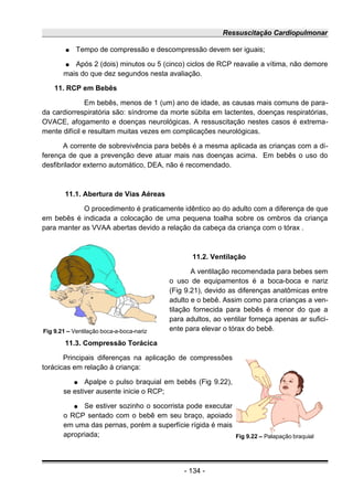 Ressuscitação Cardiopulmonar
● Tempo de compressão e descompressão devem ser iguais;
● Após 2 (dois) minutos ou 5 (cinco) ciclos de RCP reavalie a vítima, não demore
mais do que dez segundos nesta avaliação.
11. RCP em Bebês
Em bebês, menos de 1 (um) ano de idade, as causas mais comuns de para-
da cardiorrespiratória são: síndrome da morte súbita em lactentes, doenças respiratórias,
OVACE, afogamento e doenças neurológicas. A ressuscitação nestes casos é extrema-
mente difícil e resultam muitas vezes em complicações neurológicas.
A corrente de sobrevivência para bebês é a mesma aplicada as crianças com a di-
ferença de que a prevenção deve atuar mais nas doenças acima. Em bebês o uso do
desfibrilador externo automático, DEA, não é recomendado.
11.1. Abertura de Vias Aéreas
O procedimento é praticamente idêntico ao do adulto com a diferença de que
em bebês é indicada a colocação de uma pequena toalha sobre os ombros da criança
para manter as VVAA abertas devido a relação da cabeça da criança com o tórax .
11.2. Ventilação
A ventilação recomendada para bebes sem
o uso de equipamentos é a boca-boca e nariz
(Fig 9.21), devido as diferenças anatômicas entre
adulto e o bebê. Assim como para crianças a ven-
tilação fornecida para bebês é menor do que a
para adultos, ao ventilar forneça apenas ar sufici-
ente para elevar o tórax do bebê.
11.3. Compressão Torácica
Principais diferenças na aplicação de compressões
torácicas em relação à criança:
● Apalpe o pulso braquial em bebês (Fig 9.22),
se estiver ausente inicie o RCP;
● Se estiver sozinho o socorrista pode executar
o RCP sentado com o bebê em seu braço, apoiado
em uma das pernas, porém a superfície rígida é mais
apropriada;
- 134 -
Fig 9.21 – Ventilação boca-a-boca-nariz
Fig 9.22 – Palapação braquial
 