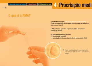 PÁG.28
1 / História do pequeno ser humano 2 / O abortamento 3 / O diagnóstico pré-natal
O que é a PMA?
Chama-se usualmente Procriação Medicamente Assistida
(PMA) ao conjunto de técnicas que permitem a procriação fora
do processo natural.
A PMA utiliza os gâmetas: espermatozóides do homem e
ovócitos da mulher.
Há principalmente duas técnicas:
• a inseminação artificial;
• a fecundação in vitro com transferência embrionária (FIV).
Micro-injecção de um espermatozóide
num ovócito com recurso a uma micro-
pipeta.
<
4/Procriação medi
 
