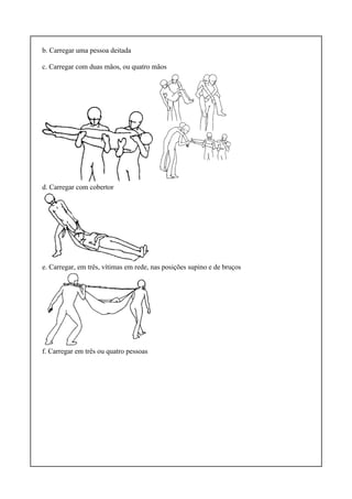 b. Carregar uma pessoa deitada
c. Carregar com duas mãos, ou quatro mãos
d. Carregar com cobertor
e. Carregar, em três, vítimas em rede, nas posições supino e de bruços
f. Carregar em três ou quatro pessoas
 
