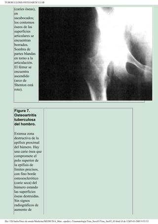 Manual de Ortopedia y Traumatología
