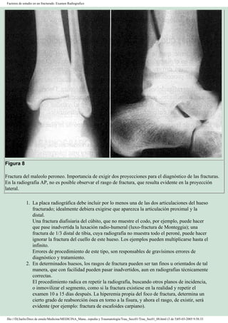 Manual de Ortopedia y Traumatología