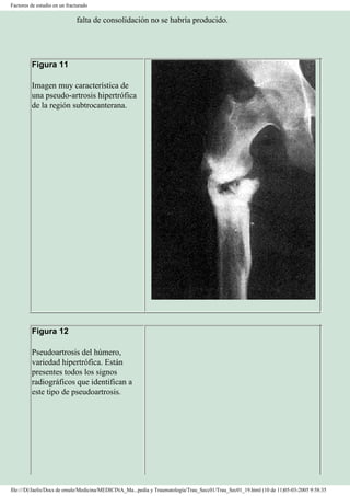 Manual de Ortopedia y Traumatología