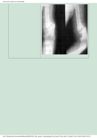 Manual de Ortopedia y Traumatología