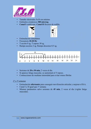 50 www.ingsanantonio.com
• Tamaño electrodos 5x10 cm mínimo
• Estímulos cronáxicos 300 microsg.
• Canal I cuádriceps. Canal II flexores de rodilla.
• Estimulación simultánea
• Frecuencia 10-20 Hz
• T acción 8 sg. T reposo 30 sg.
• Rampa ascenso 2 sg. Rampa descenso 0.5 sg.
• Sesiones de 20 a 30 min, 2 veces al día.
• Si aparece fatiga muscular, se aumentará el T reposo.
• Contracciones de mediana intensidad para evitar rotura fibrilar.
2ª y 3ª semanas
• Estimulación alternante para conseguir movilización articular y mejorar el B.A.
• Canal I y II igual que 1ª semana.
• Mismos parámetros salvo sesiones de 45 min, 2 veces al día (vigilar fatiga
muscular).
 