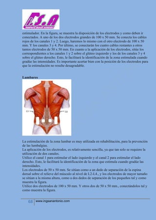 68 www.ingsanantonio.com
estimulador. En la figura, se muestra la disposición de los electrodos y como deben ir
conectados. A uno de los dos electrodos grandes de 100 x 50 mm. Se conecta los cables
rojos de los canales 1 y 2. Luego, haremos lo mismo con el otro electrodo de 100 x 50
mm. Y los canales 3 y 4. Por último, se conectarán los cuatro cables restantes a otros
tantos electrodos de 50 x 50 mm. En cuanto a la aplicación de los electrodos, sitúe los
correspondientes a los canales 1 y 2 sobre el glúteo izquierdo y los de los canales 3 y 4
sobre el glúteo derecho. Esto, le facilitará la identificación de la zona estimulada cuando
gradúe las intensidades. Es importante acertar bien con la posición de los electrodos para
que la estimulación no resulte desagradable.
Lumbares
La estimulación de la zona lumbar es muy utilizada en rehabilitación, para la prevención
de las lumbalgias.
La aplicación de los electrodos, es relativamente sencilla, ya que tan solo se requiere la
utilización de dos canales.
Utilice el canal 1 para estimular el lado izquierdo y el canal 2 para estimular el lado
derecho. Esto, le facilitará la identificación de la zona que estimula cuando gradúe las
intensidades.
Los electrodos de 50 x 50 mm. Se sitúan como a un dedo de separación de la espina
dorsal sobre el relieve del músculo al nivel de L2-L4., y los electrodos de mayor tamaño
se sitúan a la misma altura, como a dos dedos de separación de los pequeños tal y como
muestra la figura.
Utilice dos electrodos de 100 x 50 mm. Y otros dos de 50 x 50 mm., conectándolos tal y
como muestra la figura.
 