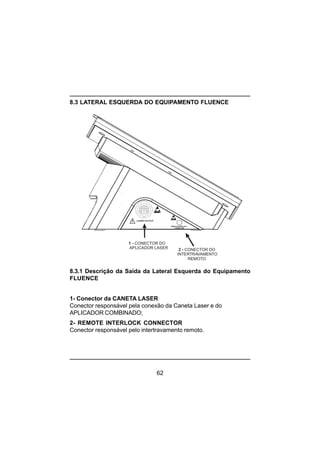 62
8.3 LATERAL ESQUERDA DO EQUIPAMENTO FLUENCE
8.3.1 Descrição da Saída da Lateral Esquerda do Equipamento
FLUENCE
1- Conector da CANETA LASER
Conector responsável pela conexão da Caneta Laser e do
APLICADOR COMBINADO;
2- REMOTE INTERLOCK CONNECTOR
Conector responsável pelo intertravamento remoto.
LASER OUTPUT
1 - CONECTOR DO
APLICADOR LASER 2 - CONECTOR DO
INTERTRAVAMENTO
REMOTO
REMOTE INTERLOCK
CONNECTOR
 