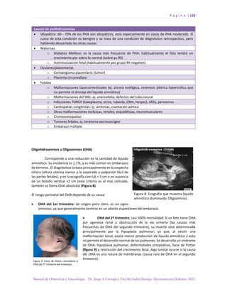 P á g i n a | 133
Manual de Obstetricia y Ginecología. Dr. Jorge A Carvajal y Dra Ma Isabel Barriga. Decimotercera Edición. 2022.
Causas de polihidroamnios
• Idiopático: 60 - 70% de los PHA son idiopáticos, esto especialmente en casos de PHA moderado. El
curso de esta condición es benigno y se trata de una condición de diagnóstico retrospectivo, pero
habiendo descartado las otras causas
• Maternas
o Diabetes Mellitus: es la causa más frecuente de PHA; habitualmente el feto tendrá un
crecimiento por sobre lo normal (sobre pc 90)
o Isoinmunización fetal (habitualmente por grupo Rh negativo)
• Ovulares/placentarias
o Corioangioma placentario (tumor)
o Placenta circunvallata
• Fetales
o Malformaciones Gastrointestinales (ej. atresia esofágica, estenosis pilórica hipertrófica que
no permite el drenaje del líquido amniótico)
o Malformaciones del SNC: ej. anencefalia, defectos del tubo neural
o Infecciones TORCH (toxoplasma, otros, rubeola, CMV, herpes), sífilis, parvovirus
o Cardiopatías congénitas: ej. arritmias, coartación aórtica
o Otras malformaciones torácicas, renales, esqueléticas, neuromusculares
o Cromosomopatías
o Tumores fetales, ej. teratoma sacrococcígeo
o Embarazo múltiple
Oligohidroamnios u Oligoamnios (OHA)
Corresponde a una reducción en la cantidad de líquido
amniótico. Su incidencia es > 1%, y es más común en embarazos
de término. El diagnóstico se basa principalmente en la sospecha
clínica (altura uterina menor a lo esperado o palpación fácil de
las partes fetales), y en la ecografía con ILA < 5 cm o en ausencia
de un bolsillo vertical >2 cm (este criterio es el más utilizado,
también se llama OHA absoluto) (Figura 8).
El riesgo perinatal del OHA depende de su causa:
• OHA del 1er trimestre: de origen poco claro, es un signo
ominoso, ya que generalmente termina en un aborto espontáneo del embarazo.
• OHA del 2º trimestre, casi 100% mortalidad: Si un feto tiene OHA
por agenesia renal u obstrucción de la vía urinaria (las causas más
frecuentes de OHA del segundo trimestre), su muerte está determinada
principalmente por la hipoplasia pulmonar, ya que, al existir una
malformación renal, existe menor producción de líquido amniótico y esto
no permite el desarrollo normal de los pulmones. Se desarrolla un síndrome
de OHA: hipoplasia pulmonar, deformidades ortopédicas, facie de Potter
(figura 9) y restricción del crecimiento fetal. Algo similar ocurre si la causa
del OHA es una rotura de membranas (causa rara de OHA en el segundo
trimestre).
 