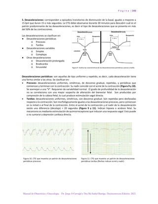 P á g i n a | 143
Manual de Obstetricia y Ginecología. Dr. Jorge A Carvajal y Dra Ma Isabel Barriga. Decimotercera Edición. 2022.
5. Desaceleraciones: corresponden a episodios transitorios de disminución de la basal, iguales o mayores a
15 lpm que duran 15 o más segundos. La CTG debe observarse durante 30 minutos para descubrir cuál es el
patrón predominante de las desaceleraciones, es decir el tipo de desaceleraciones que se presenta en más
del 50% de las contracciones.
Las desaceleraciones se clasifican en:
● Desaceleraciones periódicas
o Precoces
o Tardías
● Desaceleraciones variables
o Simples
o Complejas
● Otras desaceleraciones
o Desaceleración prolongada
o Bradicardia
o Sinusoidal
Desaceleraciones periódicas: son aquellas de tipo uniforme y repetido, es decir, cada desaceleración tiene
una forma similar a las otras. Se clasifican en:
• Precoces: desaceleraciones uniformes, simétricas, de descenso gradual, repetidas, y periódicas que
comienzan y terminan con la contracción. Su nadir coincide con el acmé de la contracción (Figura 9 y 10).
Se asemejan a una “V”. Requieren de variabilidad normal. El grado de profundidad de la desaceleración
no se correlaciona con una mayor sospecha de alteración del bienestar fetal. Son producidas por
compresión de la cabeza fetal, lo cual produce estimulación vagal directa.
• Tardías: desaceleraciones uniformes, simétricas, con descenso gradual. Son repetidas pero desfasadas
respecto a la contracción. Son morfológicamente iguales a las desaceleraciones precoces, pero comienzan
en la mitad o al final de la contracción. Entre el acmé de la contracción y el nadir de la desaceleración
existe una diferencia (decalaje) > 20 segundos (Figura 9 y 11). Indican hipoxia o acidosis fetal. Su
mecanismo es mediante estimulación de quimiorreceptores que inducen una respuesta vagal. Esto puede
o no sumarse a depresión cardiaca directa.
 