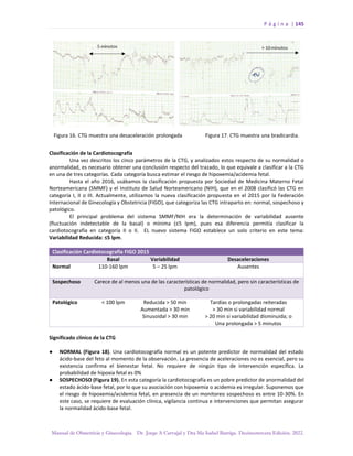 P á g i n a | 145
Manual de Obstetricia y Ginecología. Dr. Jorge A Carvajal y Dra Ma Isabel Barriga. Decimotercera Edición. 2022.
Clasificación de la Cardiotocografía
Una vez descritos los cinco parámetros de la CTG, y analizados estos respecto de su normalidad o
anormalidad, es necesario obtener una conclusión respecto del trazado, lo que equivale a clasificar a la CTG
en una de tres categorías. Cada categoría busca estimar el riesgo de hipoxemia/acidemia fetal.
Hasta el año 2016, usábamos la clasificación propuesta por Sociedad de Medicina Materno Fetal
Norteamericana (SMMF) y el Instituto de Salud Norteamericano (NIH), que en el 2008 clasificó las CTG en
categoría I, II o III. Actualmente, utilizamos la nueva clasificación propuesta en el 2015 por la Federación
Internacional de Ginecología y Obstetricia (FIGO), que categoriza las CTG intraparto en: normal, sospechoso y
patológico.
El principal problema del sistema SMMF/NIH era la determinación de variabilidad ausente
(fluctuación indetectable de la basal) o mínima (≤5 lpm), pues esa diferencia permitía clasificar la
cardiotocografía en categoría II o II. EL nuevo sistema FIGO establece un solo criterio en este tema:
Variabilidad Reducida: ≤5 lpm.
Clasificación Cardiotocografía FIGO 2015
Basal Variabilidad Desaceleraciones
Normal 110-160 lpm 5 – 25 lpm Ausentes
Sospechoso Carece de al menos una de las características de normalidad, pero sin características de
patológico
Patológico < 100 lpm Reducida > 50 min
Aumentada > 30 min
Sinusoidal > 30 min
Tardías o prolongadas reiteradas
> 30 min si variabilidad normal
> 20 min si variabilidad disminuida; o
Una prolongada > 5 minutos
Significado clínico de la CTG
● NORMAL (Figura 18). Una cardiotocografía normal es un potente predictor de normalidad del estado
ácido-base del feto al momento de la observación. La presencia de aceleraciones no es esencial, pero su
existencia confirma el bienestar fetal. No requiere de ningún tipo de intervención específica. La
probabilidad de hipoxia fetal es 0%
● SOSPECHOSO (Figura 19). En esta categoría la cardiotocografía es un pobre predictor de anormalidad del
estado ácido-base fetal, por lo que su asociación con hipoxemia o acidemia es irregular. Suponemos que
el riesgo de hipoxemia/acidemia fetal, en presencia de un monitoreo sospechoso es entre 10-30%. En
este caso, se requiere de evaluación clínica, vigilancia continua e intervenciones que permitan asegurar
la normalidad ácido-base fetal.
 