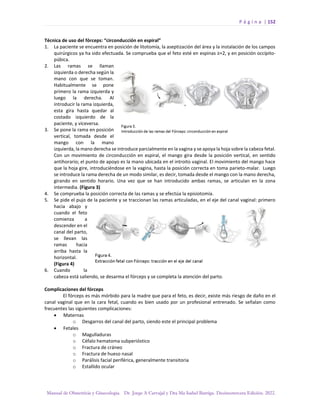 P á g i n a | 152
Manual de Obstetricia y Ginecología. Dr. Jorge A Carvajal y Dra Ma Isabel Barriga. Decimotercera Edición. 2022.
Técnica de uso del fórceps: “circonducción en espiral”
1. La paciente se encuentra en posición de litotomía, la aseptización del área y la instalación de los campos
quirúrgicos ya ha sido efectuada. Se comprueba que el feto esté en espinas ≥+2, y en posición occípito-
púbica.
2. Las ramas se llaman
izquierda o derecha según la
mano con que se toman.
Habitualmente se pone
primero la rama izquierda y
luego la derecha. Al
introducir la rama izquierda,
esta gira hasta quedar al
costado izquierdo de la
paciente, y viceversa.
3. Se pone la rama en posición
vertical, tomada desde el
mango con la mano
izquierda, la mano derecha se introduce parcialmente en la vagina y se apoya la hoja sobre la cabeza fetal.
Con un movimiento de circonducción en espiral, el mango gira desde la posición vertical, en sentido
antihorario; el punto de apoyo es la mano ubicada en el introito vaginal. El movimiento del mango hace
que la hoja gire, introduciéndose en la vagina, hasta la posición correcta en toma parieto-malar. Luego
se introduce la rama derecha de un modo similar, es decir, tomada desde el mango con la mano derecha,
girando en sentido horario. Una vez que se han introducido ambas ramas, se articulan en la zona
intermedia. (Figura 3)
4. Se comprueba la posición correcta de las ramas y se efectúa la episiotomía.
5. Se pide el pujo de la paciente y se traccionan las ramas articuladas, en el eje del canal vaginal: primero
hacia abajo y
cuando el feto
comienza a
descender en el
canal del parto,
se llevan las
ramas hacia
arriba hasta la
horizontal.
(Figura 4)
6. Cuando la
cabeza está saliendo, se desarma el fórceps y se completa la atención del parto.
Complicaciones del fórceps
El fórceps es más mórbido para la madre que para el feto, es decir, existe más riesgo de daño en el
canal vaginal que en la cara fetal, cuando es bien usado por un profesional entrenado. Se señalan como
frecuentes las siguientes complicaciones:
• Maternas
o Desgarros del canal del parto, siendo este el principal problema
• Fetales
o Magulladuras
o Céfalo hematoma subperióstico
o Fractura de cráneo
o Fractura de hueso nasal
o Parálisis facial periférica, generalmente transitoria
o Estallido ocular
 