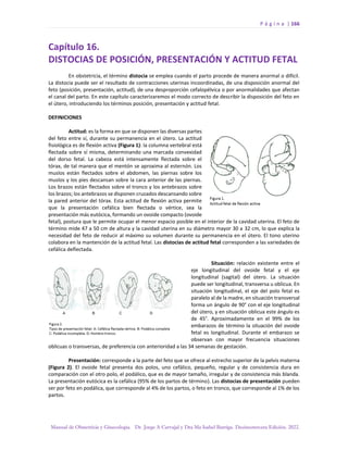 P á g i n a | 166
Manual de Obstetricia y Ginecología. Dr. Jorge A Carvajal y Dra Ma Isabel Barriga. Decimotercera Edición. 2022.
Capítulo 16.
DISTOCIAS DE POSICIÓN, PRESENTACIÓN Y ACTITUD FETAL
En obstetricia, el término distocia se emplea cuando el parto procede de manera anormal o difícil.
La distocia puede ser el resultado de contracciones uterinas incoordinadas, de una disposición anormal del
feto (posición, presentación, actitud), de una desproporción cefalopélvica o por anormalidades que afectan
el canal del parto. En este capítulo caracterizaremos el modo correcto de describir la disposición del feto en
el útero, introduciendo los términos posición, presentación y actitud fetal.
DEFINICIONES
Actitud: es la forma en que se disponen las diversas partes
del feto entre sí, durante su permanencia en el útero. La actitud
fisiológica es de flexión activa (Figura 1): la columna vertebral está
flectada sobre sí misma, determinando una marcada convexidad
del dorso fetal. La cabeza está intensamente flectada sobre el
tórax, de tal manera que el mentón se aproxima al esternón. Los
muslos están flectados sobre el abdomen, las piernas sobre los
muslos y los pies descansan sobre la cara anterior de las piernas.
Los brazos están flectados sobre el tronco y los antebrazos sobre
los brazos; los antebrazos se disponen cruzados descansando sobre
la pared anterior del tórax. Esta actitud de flexión activa permite
que la presentación cefálica bien flectada o vértice, sea la
presentación más eutócica, formando un ovoide compacto (ovoide
fetal), postura que le permite ocupar el menor espacio posible en el interior de la cavidad uterina. El feto de
término mide 47 a 50 cm de altura y la cavidad uterina en su diámetro mayor 30 a 32 cm, lo que explica la
necesidad del feto de reducir al máximo su volumen durante su permanencia en el útero. El tono uterino
colabora en la mantención de la actitud fetal. Las distocias de actitud fetal corresponden a las variedades de
cefálica deflectada.
Situación: relación existente entre el
eje longitudinal del ovoide fetal y el eje
longitudinal (sagital) del útero. La situación
puede ser longitudinal, transversa u oblicua. En
situación longitudinal, el eje del polo fetal es
paralelo al de la madre, en situación transversal
forma un ángulo de 90° con el eje longitudinal
del útero, y en situación oblicua este ángulo es
de 45°. Aproximadamente en el 99% de los
embarazos de término la situación del ovoide
fetal es longitudinal. Durante el embarazo se
observan con mayor frecuencia situaciones
oblicuas o transversas, de preferencia con anterioridad a las 34 semanas de gestación.
Presentación: corresponde a la parte del feto que se ofrece al estrecho superior de la pelvis materna
(Figura 2). El ovoide fetal presenta dos polos, uno cefálico, pequeño, regular y de consistencia dura en
comparación con el otro polo, el podálico, que es de mayor tamaño, irregular y de consistencia más blanda.
La presentación eutócica es la cefálica (95% de los partos de término). Las distocias de presentación pueden
ser por feto en podálica, que corresponde al 4% de los partos, o feto en tronco, que corresponde al 1% de los
partos.
 