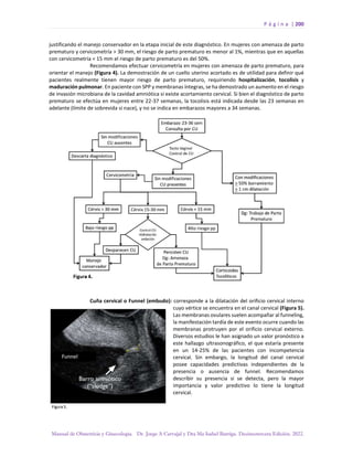 P á g i n a | 200
Manual de Obstetricia y Ginecología. Dr. Jorge A Carvajal y Dra Ma Isabel Barriga. Decimotercera Edición. 2022.
justificando el manejo conservador en la etapa inicial de este diagnóstico. En mujeres con amenaza de parto
prematuro y cervicometría > 30 mm, el riesgo de parto prematuro es menor al 1%, mientras que en aquellas
con cervicometría < 15 mm el riesgo de parto prematuro es del 50%.
Recomendamos efectuar cervicometría en mujeres con amenaza de parto prematuro, para
orientar el manejo (Figura 4). La demostración de un cuello uterino acortado es de utilidad para definir qué
pacientes realmente tienen mayor riesgo de parto prematuro, requiriendo hospitalización, tocolisis y
maduración pulmonar. En paciente con SPP y membranas íntegras, se ha demostrado un aumento en el riesgo
de invasión microbiana de la cavidad amniótica si existe acortamiento cervical. Si bien el diagnóstico de parto
prematuro se efectúa en mujeres entre 22-37 semanas, la tocolisis está indicada desde las 23 semanas en
adelante (límite de sobrevida si nace), y no se indica en embarazos mayores a 34 semanas.
Cuña cervical o Funnel (embudo): corresponde a la dilatación del orificio cervical interno
cuyo vértice se encuentra en el canal cervical (Figura 5).
Las membranas ovulares suelen acompañar al funneling,
la manifestación tardía de este evento ocurre cuando las
membranas protruyen por el orificio cervical externo.
Diversos estudios le han asignado un valor pronóstico a
este hallazgo ultrasonográfico, el que estaría presente
en un 14-25% de las pacientes con incompetencia
cervical. Sin embargo, la longitud del canal cervical
posee capacidades predictivas independientes de la
presencia o ausencia de funnel. Recomendamos
describir su presencia si se detecta, pero la mayor
importancia y valor predictivo lo tiene la longitud
cervical.
 