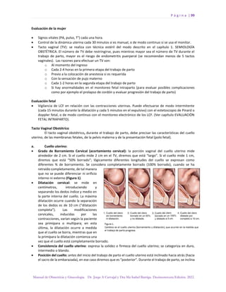 P á g i n a | 99
Manual de Obstetricia y Ginecología. Dr. Jorge A Carvajal y Dra Ma Isabel Barriga. Decimotercera Edición. 2022.
Evaluación de la mujer
• Signos vitales (PA, pulso, T°) cada una hora.
• Control de la dinámica uterina cada 30 minutos si es manual, o de modo continuo si se usa el monitor.
• Tacto vaginal (TV): se realiza con técnica estéril del modo descrito en el capítulo 1. SEMIOLOGÍA
OBSTÉTRICA. El número de TV debe restringirse, pues mientras mayor sea el número de TV durante el
trabajo de parto, mayor es el riesgo de endometritis puerperal (se recomiendan menos de 5 tactos
vaginales). Las razones para efectuar un TV son:
o Al momento del ingreso
o Cada 2-4 horas en la primera etapa del trabajo de parto
o Previo a la colocación de anestesia si es requerida
o Con la sensación de pujo materno
o Cada 1-2 horas en la segunda etapa del trabajo de parto
o Si hay anormalidades en el monitoreo fetal intraparto (para evaluar posibles complicaciones
como por ejemplo el prolapso de cordón y evaluar progresión del trabajo de parto)
Evaluación fetal
• Vigilancia de LCF en relación con las contracciones uterinas. Puede efectuarse de modo intermitente
(cada 15 minutos durante la dilatación y cada 5 minutos en el expulsivo) con el estetoscopio de Pinard o
doppler fetal, o de modo continuo con el monitoreo electrónico de los LCF. (Ver capítulo EVALUACIÓN
FETAL INTRAPARTO).
Tacto Vaginal Obstétrico
El tacto vaginal obstétrico, durante el trabajo de parto, debe precisar las características del cuello
uterino, de las membranas fetales, de la pelvis materna y de la presentación fetal (polo fetal).
a. Cuello uterino:
• Grado de Borramiento Cervical (acortamiento cervical): la porción vaginal del cuello uterino mide
alrededor de 2 cm. Si el cuello mide 2 cm en el TV, diremos que está “largo”. Si el cuello mide 1 cm,
diremos que está “50% borrado”; lógicamente diferentes longitudes del cuello se expresan como
diferentes % de borramiento. Se considera completamente borrado (100% borrado), cuando se ha
retraído completamente, de tal manera
que no se puede diferenciar ni orificio
interno ni externo (Figura 1).
• Dilatación cervical: se mide en
centímetros, introduciendo y
separando los dedos índice y medio en
la parte interna del cuello. La máxima
dilatación ocurre cuando la separación
de los dedos es de 10 cm (“dilatación
completa”). Las modificaciones
cervicales, inducidas por las
contracciones, varían según la paciente
sea primípara o multípara; en esta
última, la dilatación ocurre a medida
que el cuello se borra, mientras que en
la primípara la dilatación comienza una
vez que el cuello está completamente borrado.
• Consistencia del cuello uterino: expresa la solidez o firmeza del cuello uterino; se categoriza en duro,
intermedio o blando.
• Posición del cuello: antes del inicio del trabajo de parto el cuello uterino está inclinado hacia atrás (hacia
el sacro de la embarazada), en ese caso diremos que es “posterior”. Durante el trabajo de parto, se inclina
 