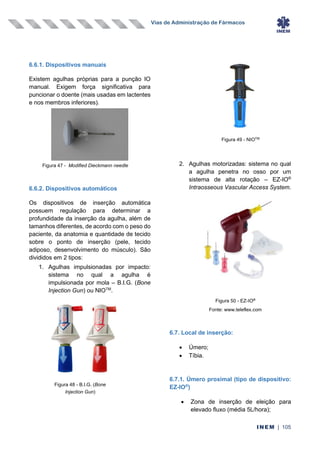 Vias de Administração de Fármacos
INEM | 105
6.6.1. Dispositivos manuais
Existem agulhas próprias para a punção IO
manual. Exigem força significativa para
puncionar o doente (mais usadas em lactentes
e nos membros inferiores).
6.6.2. Dispositivos automáticos
Os dispositivos de inserção automática
possuem regulação para determinar a
profundidade da inserção da agulha, além de
tamanhos diferentes, de acordo com o peso do
paciente, da anatomia e quantidade de tecido
sobre o ponto de inserção (pele, tecido
adiposo, desenvolvimento do músculo). São
divididos em 2 tipos:
1. Agulhas impulsionadas por impacto:
sistema no qual a agulha é
impulsionada por mola – B.I.G. (Bone
Injection Gun) ou NIOTM
.
2. Agulhas motorizadas: sistema no qual
a agulha penetra no osso por um
sistema de alta rotação – EZ-IO®
Intraosseous Vascular Access System.
6.7. Local de inserção:
• Úmero;
• Tíbia.
6.7.1. Úmero proximal (tipo de dispositivo:
EZ-IO®
)
• Zona de inserção de eleição para
elevado fluxo (média 5L/hora);
Figura 48 - B.I.G. (Bone
Injection Gun)
Figura 50 - EZ-IO®
Fonte: www.teleflex.com
Figura 47 - Modified Dieckmann needle
Figura 49 - NIOTM
 