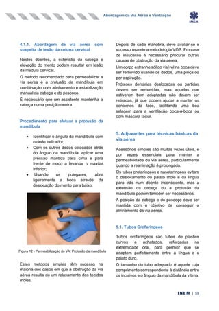 Abordagem da Via Aérea e Ventilação
INEM | 59
4.1.1. Abordagem da via aérea com
suspeita de lesão da coluna cervical
Nestes doentes, a extensão da cabeça e
elevação do mento podem resultar em lesão
da medula cervical.
O método recomendado para permeabilizar a
via aérea é a protusão da mandíbula em
combinação com alinhamento e estabilização
manual da cabeça e do pescoço.
É necessário que um assistente mantenha a
cabeça numa posição neutra.
Procedimento para efetuar a protusão da
mandíbula
• Identificar o ângulo da mandíbula com
o dedo indicador;
• Com os outros dedos colocados atrás
do ângulo da mandíbula, aplicar uma
pressão mantida para cima e para
frente de modo a levantar o maxilar
inferior;
• Usando os polegares, abrir
ligeiramente a boca através da
deslocação do mento para baixo.
Estes métodos simples têm sucesso na
maioria dos casos em que a obstrução da via
aérea resulta de um relaxamento dos tecidos
moles.
Depois de cada manobra, deve avaliar-se o
sucesso usando a metodologia VOS. Em caso
de insucesso é necessário procurar outras
causas de obstrução da via aérea.
Um corpo estranho sólido visível na boca deve
ser removido usando os dedos, uma pinça ou
por aspiração.
Próteses dentárias deslocadas ou partidas
devem ser removidas, mas aquelas que
estiverem bem adaptadas não devem ser
retiradas, já que podem ajudar a manter os
contornos da face, facilitando uma boa
selagem para a ventilação boca-a-boca ou
com máscara facial.
5. Adjuvantes para técnicas básicas da
via aérea
Acessórios simples são muitas vezes úteis, e
por vezes essenciais para manter a
permeabilidade da via aérea, particularmente
quando a reanimação é prolongada.
Os tubos orofaríngeos e nasofaríngeos evitam
o deslocamento do palato mole e da língua
para trás num doente inconsciente, mas a
extensão da cabeça ou a protusão da
mandíbula podem também ser necessários.
A posição da cabeça e do pescoço deve ser
mantida com o objetivo de conseguir o
alinhamento da via aérea.
5.1. Tubos Orofaríngeos
Tubos orofaríngeos são tubos de plástico
curvos e achatados, reforçados na
extremidade oral, para permitir que se
adaptem perfeitamente entre a língua e o
palato duro.
O tamanho do tubo adequado é aquele cujo
comprimento correspondente à distância entre
os incisivos e o ângulo da mandíbula da vítima.
Figura 12 - Permeabilização da VA: Protusão da mandíbula
 