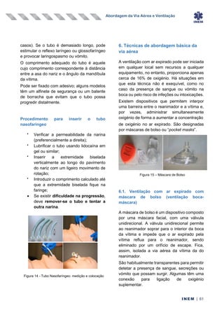 Abordagem da Via Aérea e Ventilação
INEM | 61
casos). Se o tubo é demasiado longo, pode
estimular o reflexo laríngeo ou glossofaríngeo
e provocar laringospasmo ou vómito.
O comprimento adequado do tubo é aquele
cujo comprimento correspondente à distância
entre a asa do nariz e o ângulo da mandíbula
da vítima.
Pode ser fixado com adesivo; alguns modelos
têm um alfinete de segurança ou um batente
de borracha que evitam que o tubo possa
progredir distalmente.
Procedimento para inserir o tubo
nasofaríngeo
•
Verificar a permeabilidade da narina
(preferencialmente a direita);
•
Lubrificar o tubo usando lidocaína em
gel ou similar;
•
Inserir a extremidade biselada
verticalmente ao longo do pavimento
do nariz com um ligeiro movimento de
rotação;
•
Introduzir o comprimento calculado até
que a extremidade biselada fique na
faringe;
• Se existir dificuldade na progressão,
deve remover-se o tubo e tentar a
outra narina.
6. Técnicas de abordagem básica da
via aérea
A ventilação com ar expirado pode ser iniciada
em qualquer local sem recursos a qualquer
equipamento, no entanto, proporciona apenas
cerca de 16% de oxigénio. Há situações em
que esta técnica não é exequível, como no
caso da presença de sangue ou vómito na
boca ou pelo risco de infeções ou intoxicações.
Existem dispositivos que permitem interpor
uma barreira entre o reanimador e a vítima e,
por vezes, administrar simultaneamente
oxigénio de forma a aumentar a concentração
de oxigénio no ar expirado. São designadas
por máscaras de bolso ou “pocket masks”.
6.1. Ventilação com ar expirado com
máscara de bolso (ventilação boca-
máscara)
A máscara de bolso é um dispositivo composto
por uma máscara facial, com uma válvula
unidirecional. A válvula unidirecional permite
ao reanimador soprar para o interior da boca
da vítima e impede que o ar expirado pela
vítima reflua para o reanimador, sendo
eliminado por um orifício de escape. Fica,
assim, isolada a via aérea da vítima da do
reanimador.
São habitualmente transparentes para permitir
detetar a presença de sangue, secreções ou
vómito que possam surgir. Algumas têm uma
conexão para ligação de oxigénio
suplementar.
Figura 14 - Tubo Nasofaríngeo: medição e colocação
Figura 15 – Máscara de Bolso
 