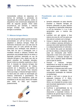Suporte Avançado de Vida
66 | INEM
necessidades práticas de segurança em
termos de ventilação e prevenção da
regurgitação de conteúdo gástrico, sendo os
dispositivos mais consensuais designados de
DSG de segunda geração. Entre estes
encontram-se, por exemplo, a máscara
laríngea ProSeal, I-gel, Supreme, tubo
laríngeo e Combitube.
7.1. Máscara laríngea clássica
É um tubo de grande calibre que tem numa das
extremidades um cuff em forma de elipse,
adaptável à abertura laríngea. Pode ser
facilmente introduzido com uma alta taxa de
sucesso após um curto período de treino,
permitindo uma ventilação mais eficiente e
mais fácil do que a conseguida com o
insuflador manual e máscara. Embora não
garantindo uma proteção total da via aérea, a
aspiração pulmonar associada ao uso da
máscara laríngea é rara, desde que não se
gerem pressões de insuflação elevadas.
Devem evitar-se pressões superiores a 20cm
H2O. A inserção da máscara laríngea não
requer extensão acentuada da cabeça,
podendo ser o dispositivo de escolha na
presença de lesão cervical. Pelo reduzido
treino que exige, a máscara laríngea mostrou-
se fiável para ser usada na reanimação por
médicos, enfermeiros e paramédicos. Tal
como a maioria dos dispositivos, pode ser
reutilizável ou de uso único. Serviu de modelo
para todos os DSG que surgiram
posteriormente.
Procedimento para colocar a máscara
laríngea:
• tamanho adequado ao peso descrito
Escolher a máscara laríngea de
tamanho adequado ao peso descrito
no dispositivo e desinsuflar totalmente
o cuff (os tamanhos 3, 4 ou 5 são
apropriados para a maioria dos
adultos);
• Lubrificar com gel apenas a face
externa da zona do cuff (na parte que
não está em contacto com a laringe);
• Colocar o doente em decúbito dorsal
com a cabeça e pescoço alinhados (o
pescoço deve estar ligeiramente fletido
e a cabeça ligeiramente em extensão);
• Se o doente não puder ser abordado
por trás da cabeça, a máscara laríngea
pode ser introduzida pela frente,
segurando o tubo como uma caneta e
introduzindo a máscara laríngea na
boca, com a abertura distal orientada
para os pés do doente;
• Avançar a máscara laríngea
deslizando-a ao longo do palato duro
até à parede posterior da faringe;
• Pressionar a máscara para trás e para
baixo até sentir resistência (isso
corresponde localização da máscara
na hipofaringe);
• Insuflar o cuff com o volume de ar
adequado (máscara nº 3: 20mL;
máscara nº 4: 30mL; máscara nº 5:
40mL); se a inserção foi correta o tubo
será levantado ligeiramente (1 a 2cm)
para fora da boca;
• Confirmar a permeabilidade da via
aérea e ventilação auscultando e
observando a expansão torácica. A
existência de grande fuga é indício de
mau posicionamento da máscara
laríngea;
Figura 19 - Máscara laríngea
 