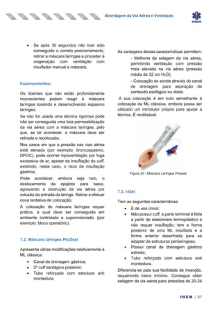 Abordagem da Via Aérea e Ventilação
INEM | 67
• Se após 30 segundos não tiver sido
conseguido o correto posicionamento,
retirar a máscara laríngea e proceder à
oxigenação com ventilação com
insuflador manual e máscara.
Inconvenientes:
Os doentes que não estão profundamente
inconscientes podem reagir à máscara
laríngea tossindo e desenvolvendo espasmo
laríngeo;
Se não for usada uma técnica rigorosa pode
não ser conseguida uma boa permeabilização
da via aérea com a máscara laríngea, pelo
que, se tal acontecer, a máscara deve ser
retirada e recolocada;
Nos casos em que a pressão nas vias aérea
está elevada (por exemplo, broncospasmo,
DPOC), pode ocorrer hipoventilação por fuga
excessiva de ar, apesar da insuflação do cuff,
existindo, neste caso, o risco de insuflação
gástrica;
Pode acontecer, embora seja raro, o
deslocamento da epiglote para baixo,
agravando a obstrução da via aérea por
oclusão da entrada da laringe. Retirar e efetuar
nova tentativa de colocação;
A colocação de máscara laríngea requer
prática, a qual deve ser conseguida em
ambiente controlado e supervisionado, (por
exemplo: bloco operatório).
7.2. Máscara laríngea ProSeal
Apresenta várias modificações relativamente à
ML clássica:
• Canal de drenagem gástrica;
• 2º cuff esofágico posterior;
• Tubo reforçado com estrutura anti
mordedura.
As vantagens destas características permitem:
- Melhoria da selagem da via aérea,
permitindo ventilação com pressão
mais elevada na via aérea (pressão
média de 32 cm H2O);
- Colocação de sonda através do canal
de drenagem para aspiração de
conteúdo esofágico ou distal.
A sua colocação é em tudo semelhante à
colocação da ML clássica, embora possa ser
utilizado um introdutor próprio para ajudar a
técnica. É reutilizável.
7.3. I-Gel
Tem as seguintes características:
• É de uso único;
• Não possui cuff; a parte terminal é feita
a partir de elastómero termoplástico e
não requer insuflação; tem a forma
posterior de uma ML insuflada e a
forma anterior desenhada para se
adaptar às estruturas perilaríngeas;
• Possui canal de drenagem gástrico
estreito;
• Tubo reforçado com estrutura anti
mordedura.
Diferencia-se pela sua facilidade de inserção,
requerendo treino mínimo. Consegue obter
selagem da via aérea para pressões de 20-24
Figura 20 - Máscara Laríngea Proseal
 