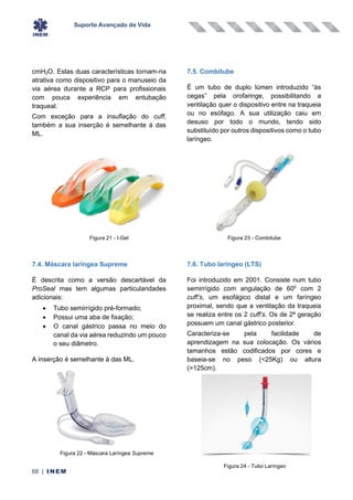 Suporte Avançado de Vida
68 | INEM
cmH2O. Estas duas características tornam-na
atrativa como dispositivo para o manuseio da
via aérea durante a RCP para profissionais
com pouca experiência em entubação
traqueal.
Com exceção para a insuflação do cuff,
também a sua inserção é semelhante à das
ML.
7.4. Máscara laríngea Supreme
É descrita como a versão descartável da
ProSeal mas tem algumas particularidades
adicionais:
• Tubo semirrígido pré-formado;
• Possui uma aba de fixação;
• O canal gástrico passa no meio do
canal da via aérea reduzindo um pouco
o seu diâmetro.
A inserção é semelhante à das ML.
7.5. Combitube
É um tubo de duplo lúmen introduzido “às
cegas” pela orofaringe, possibilitando a
ventilação quer o dispositivo entre na traqueia
ou no esófago. A sua utilização caiu em
desuso por todo o mundo, tendo sido
substituído por outros dispositivos como o tubo
laríngeo.
7.6. Tubo laríngeo (LTS)
Foi introduzido em 2001. Consiste num tubo
semirrígido com angulação de 600
com 2
cuff’s, um esofágico distal e um faríngeo
proximal, sendo que a ventilação da traqueia
se realiza entre os 2 cuff’s. Os de 2ª geração
possuem um canal gástrico posterior.
Caracteriza-se pela facilidade de
aprendizagem na sua colocação. Os vários
tamanhos estão codificados por cores e
baseia-se no peso (<25Kg) ou altura
(>125cm).
Figura 21 - I-Gel
Figura 22 - Máscara Laríngea Supreme
Figura 24 - Tubo Laríngeo
Figura 23 - Combitube
 