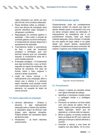 Abordagem da Via Aérea e Ventilação
INEM | 73
rígido (introdutor) por dentro do tubo
para lhe dar uma curvatura adequada;
• Peças dentárias soltas ou próteses –
Uma boa técnica de entubação deve
permitir identificar estas situações e
ultrapassar o problema;
• Regurgitação do conteúdo gástrico e
aspiração – Para evitar a entrada de
conteúdo gástrico na árvore brônquica,
é fundamental ter sempre disponível o
equipamento de aspiração;
• Traumatismos faciais e queimaduras
da face – pode ser impossível
conseguir a ventilação, quer com
técnicas básicas quer por entubação
traqueal. A cricotirotomia pode ser a
única medida possível;
• Entubação esofágica – É fundamental
que seja reconhecida, o que, se forem
seguidas as regras da entubação, não
deixará de acontecer. Em caso de
dúvida, retirar o tubo, oxigenar o
doente e tentar novamente;
• Lesão da coluna cervical – É
habitualmente uma entubação difícil e
requer que a cabeça e o pescoço
sejam mantidos numa posição neutra
com imobilização manual por um outro
elemento, na suspeita de lesão da
coluna cervical.
7.8. Outros adjuvantes da entubação
• Lâminas alternativas – Embora o
tamanho 3 seja habitualmente
adequado para a maioria dos doentes,
é necessário dispor de lâminas mais
longas para algumas situações.
Poderá também ser necessário dispor
de lâminas retas.
• Introdutores – Já foram descritos
anteriormente.
8. Cricotirotomia por agulha
Ocasionalmente, pode ser completamente
impossível ventilar um doente que está em
apneia. Nestes casos, é necessário criar uma
via aérea cirúrgica abaixo da obstrução. A
traqueostomia de emergência não é um
procedimento indicado, dado que requer
material adequado, treino e tempo. A inserção
de uma agulha de largo calibre é um gesto
rápido que requer apenas equipamento
simples e é relativamente pouco arriscada. No
entanto, é apenas uma medida temporária.
8.1. Procedimento
• Colocar o doente em decúbito dorsal
com ligeira extensão da cabeça.
• Identificar a membrana cricóide (entre
a cartilagem tiróide e a cartilagem
cricóide);
• Puncionar na vertical e na linha média
com uma cânula de calibre 14G ou
maior, ligada a uma seringa efetuando
ligeira aspiração. Assim que for
aspirado ar, a cânula está na traqueia;
• Mover a agulha, no sentido caudal até
fazer um ângulo de 45º com o plano do
pescoço e avançar a cânula retirando o
mandril;
• Conectar a cânula a uma fonte de
oxigénio com alto débito, 12-15 L/min,
Figura 26 - Kit de cricotirotomia
 