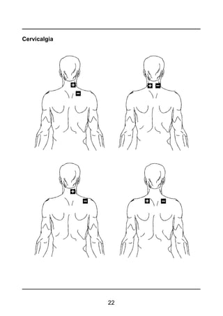 22
Cervicalgia
 