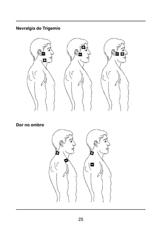 25
Nevralgia do Trigemio
Dor no ombro
 