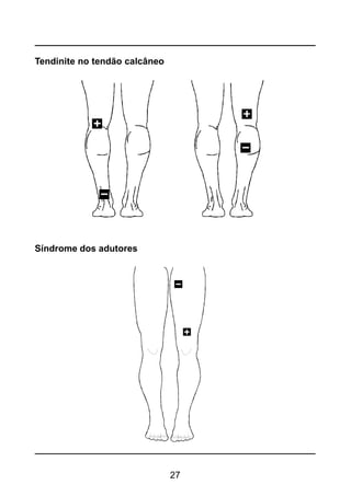 27
Tendinite no tendão calcâneo
Síndrome dos adutores
 