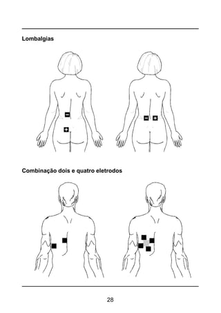 28
Lombalgias
Combinação dois e quatro eletrodos
 