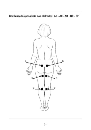 31
Combinações possíveis dos eletrodos: AC - AE - AB - BD - BF
 