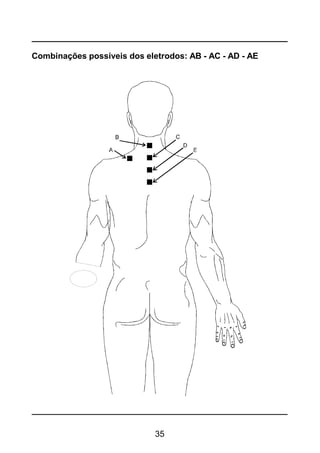 35
Combinações possíveis dos eletrodos: AB - AC - AD - AE
 