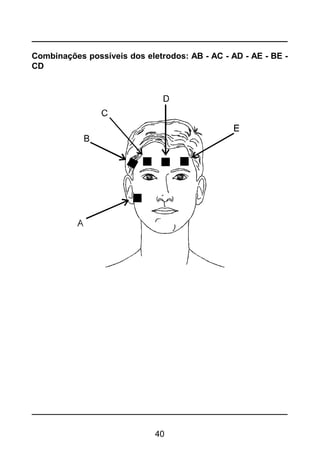 40
Combinações possíveis dos eletrodos: AB - AC - AD - AE - BE -
CD
 