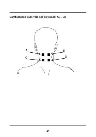 41
Combinações possíveis dos eletrodos: AB - CD
 