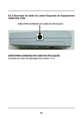 65
9.3.2 Descrição da Saída da Lateral Esquerda do Equipamento
TENS-FES HTM
SAÍDA PARA CONEXÃO DO CABO DE APLICAÇÃO.
Conexão do cabo de aplicação dos canais 1 e 2.
 