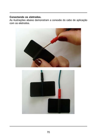 70
Conectando os eletrodos.
As ilustrações abaixo demonstram a conexão do cabo de aplicação
com os eletrodos.
 