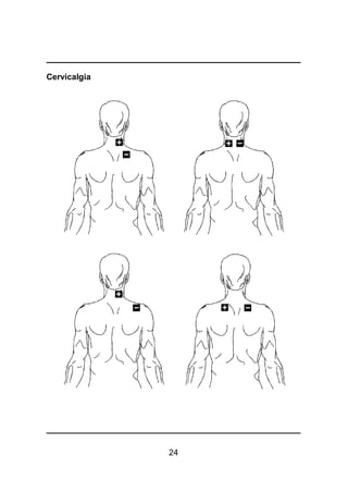 24
Cervicalgia
 