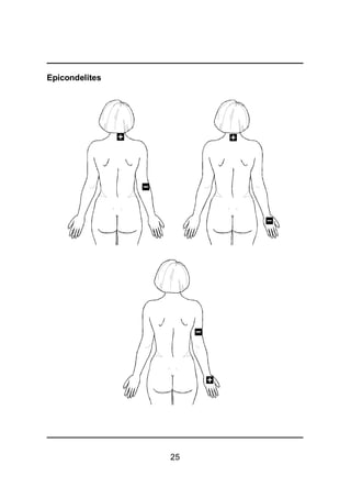 25
Epicondelites
 
