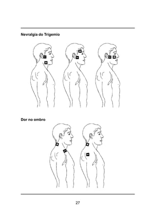 27
Nevralgia do Trigemio
Dor no ombro
 