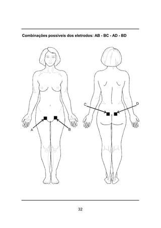 32
Combinações possíveis dos eletrodos: AB - BC - AD - BD
 