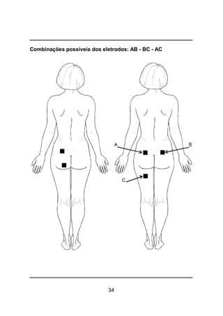 34
Combinações possíveis dos eletrodos: AB - BC - AC
 