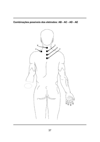 37
Combinações possíveis dos eletrodos: AB - AC - AD - AE
 
