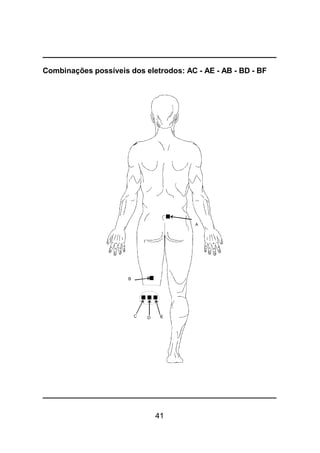41
Combinações possíveis dos eletrodos: AC - AE - AB - BD - BF
 