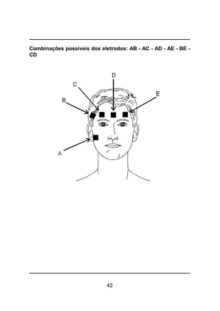 42
Combinações possíveis dos eletrodos: AB - AC - AD - AE - BE -
CD
 