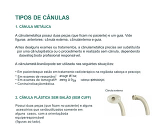 TIPOS DE CÂNULAS
1. CÂNULA METÁLICA
A cânulametálica possui duas peças (que ficam no paciente) e um guia. Vide
figuras anteriores: cânula externa, cânulainterna e guia.
Antes dealguns exames ou tratamentos, a cânulametálica precisa ser substituída
por uma cânulaplástica ou o procedimento é realizado sem cânula, dependendo
daavaliaçãodo profissional responsável.
A cânulametálicanãopode ser utilizada nas seguintes situações:
• Em pacientesque estão em tratamento radioterápico na regiãoda cabeça e pescoço;
a
n i cabeça e
• Contraindicaçãomédica.
da
ca;
ã
é
g
n
a re
mag
Em exames de tomografi
Em exames de ressonânc
•
•
2. CÂNULA PLÁSTICA SEM BALÃO (SEM CUFF)
Possui duas peças (que ficam no paciente) e alguns
acessórios que serãoutilizados somente em
alguns casos, com a orientaçãoda
equiperesponsável
(figuras ao lado).
pescoço;
Cânula externa
 
