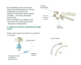 3. CÂNULA PLÁSTICA COM BALÃO (COM
CUFF)
Possui duas peças (que ficam no paciente)
e um guia.
Cânula externa
A cânulaplástica sem cuff possui
tampa de próteseantitosse, válvula
defonação ou conector de
oxigênio. Você deve utilizar sempre
um deles, pois esta cânulanão
possuitrava,
como a metálica ou a plástica com
cuff. Com isso, você evita que ela
desloque e acabesaindo.
Guia
Válvula para injetar
ou retirar ar
dobalão interno
Tampa de
proteção
antitosse
Válvula
defonação
Cânula interna
Balonete
externo
para oxigênio
Conector
 