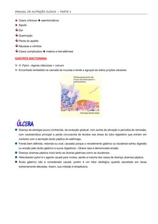 MANUAL DE NUTRIÇÃO CLÍNICA – PARTE II


  Casos crônicos  assintomáticos
  Aguda
  Dor
  Queimação
  Perda do apetite
  Náuseas e vômitos
  Casos complicados  melena e hematêmese

GASTRITE BACTERIANA

  H. Pylori - Agente infeccioso + comum
  Encontrado embebido na camada da mucosa e tende a agrupar-se sobre junções celulares




  Doença de etiologia pouco conhecida, de evolução gradual, com surtos de ativação e períodos de remissão,
  com característica principal a perda circunscrita de tecidos nas áreas do tubo digestório que entram em
  contacto com a secreção ácido péptica do estômago.
  Ferida bem definida, redonda ou oval, causada porque o revestimento gástrico ou duodenal sofreu digestão
  ou erosão pelo ácido gástrico e sucos digestivos - Úlcera rasa é denominada erosão.
  Doença ulcerosa péptica inclui tanto as úlceras gástricas como as duodenais.
  Helicobacter pylori é o agente causal para muitos, senão a maioria dos casos de doença ulcerosa péptica.
  Ácido gástrico não é considerado causal, porém é um fator etiológico quando secretado em taxas
  extremamente elevadas. Assim, sua inibição é terapêutica.
 