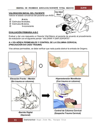 [MANUAL DE PRIMEROS AUXILIOS/SOPORTÉ VITAL BÁSICO] 2.016
11 Instructor Hugo Jose Ma. Vargas Cruz
VALORACION INICIAL DEL PACIENTE
Valorar el estado conciencia del paciente con AVDI:
 A-lerta.
 Estímulos V-erbales.
 Estímulos D-oloros.
 I-nconsciente
EVALUACIÓN PRIMARIA A-B-C
Evaluar y dar una respuesta un Soporte Vital Básico al paciente de acuerdo al procedimiento
de evaluación con el siguiente pensar “VALORAR Y DAR SOPORTE”:
A = VÍA AÉREA PERMEABLES Y CONTROL DE LA COLUMNA CERVICAL
(PRECAUCIÓN EN CASO TRAUMA)
Vías aéreas permeables, se debe verificar que nada pueda obstruir la entrada de Oxigeno.
-Barrido Digital
(Opcional)
- Control de Columna Cervical
(Sospecha Trauma Cervical)
-Hiperextensión Mandibular
(Con trauma en columna)
-Elevación Frente – Mentón
(Sin trauma en columna)
 