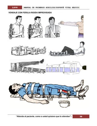 2.016 [MANUAL DE PRIMEROS AUXILIOS/SOPORTÉ VITAL BÁSICO]
“Atienda al paciente, como a usted quisiera que lo atiendan”| 58
VENDAJE CON FERULA RIGIDA IMPROVISADA
 