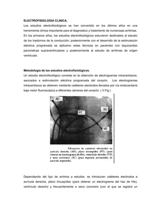 ELECTROFISIOLOGIA CLINICA.
Los estudios electrofisiológicos se han convertido en los últimos años en una
herramienta clínica importante para el diagnóstico y tratamiento de numerosas arritmias.
En los primeros años, los estudios electrofisiológicos estuvieron destinados al estudio
de los trastornos de la conducción; posteriormente con el desarrollo de la estimulación
eléctrica programada se aplicaron estas técnicas en pacientes con taquicardias
paroxísticas supraventriculares y posteriormente al estudio de arritmias de origen
ventricular.




Metodología de los estudios electrofisiológicos.
Un estudio electrofisiológico consiste en la obtención de electrogramas intracardíacos,
asociados a estimulación eléctrica programada del corazón.              Los electrogramas
intracardíacos se obtienen mediante catéteres electrodos llevados por vía endocavitaria
bajo visión fluoroscópica a diferentes cámaras del corazón. ( V.Fig )




Dependiendo del tipo de arritmia a estudiar, se introducen catéteres electrodos a
aurícula derecha, plano tricuspídeo (para obtener un electrograma del haz de His),
ventrículo derecho y frecuentemente a seno coronario (con el que se registra un
 
